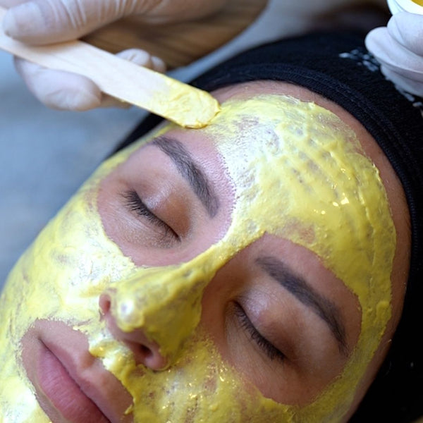 Peeling Químico