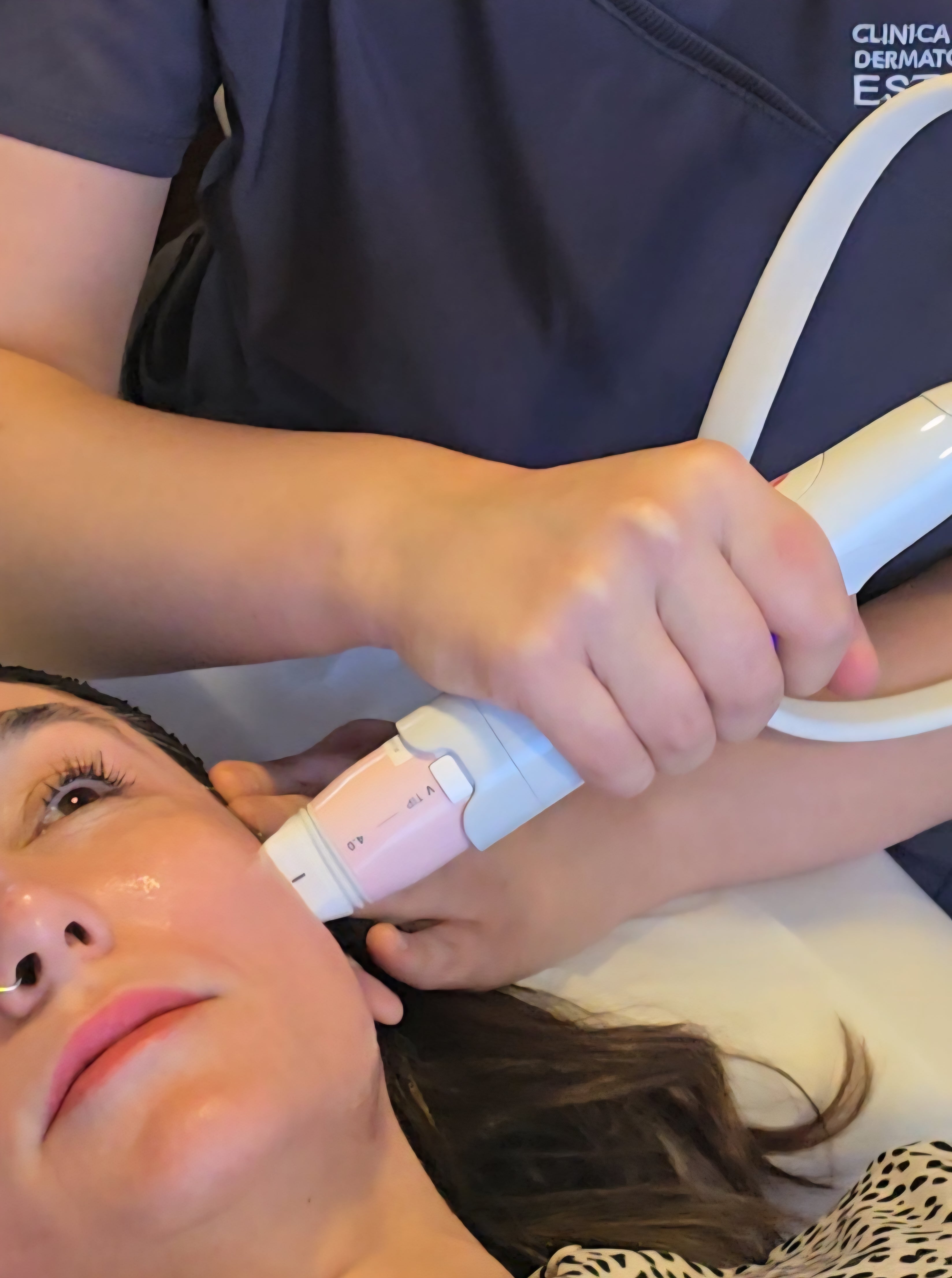 Volformer (Volnewmer + Ultraformer MPT)