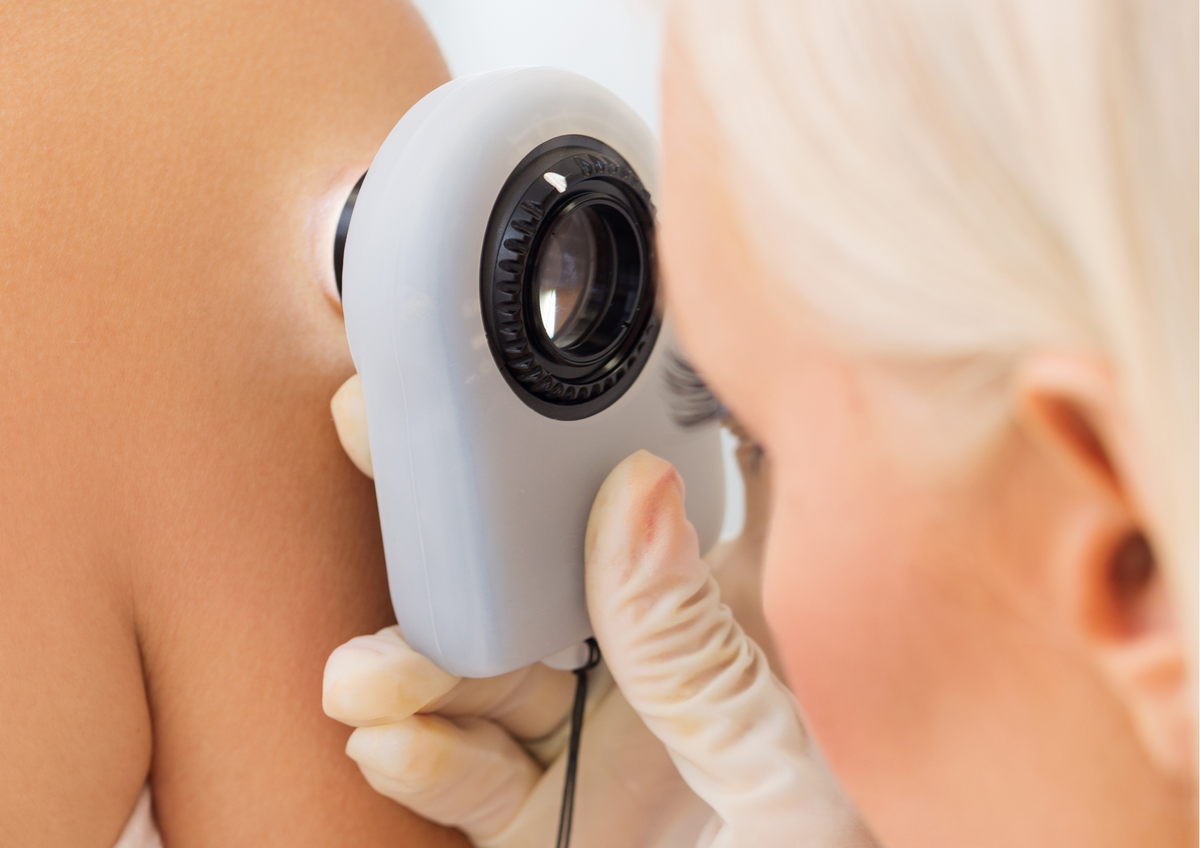 Consulta dermatológica · Dermatología Estoril