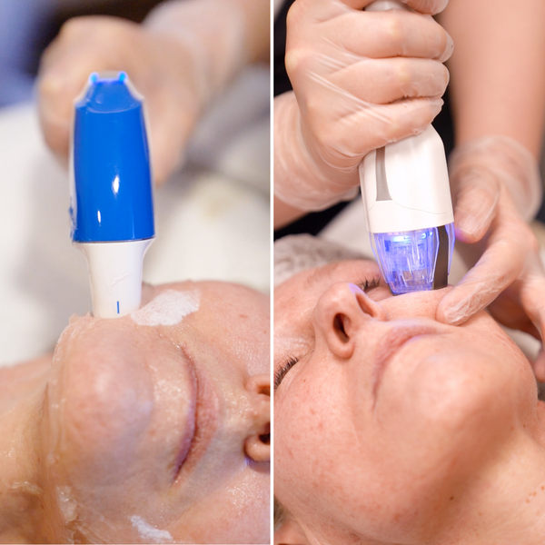 Protocolo lifting: Ultraformer MPT + Virtue RF