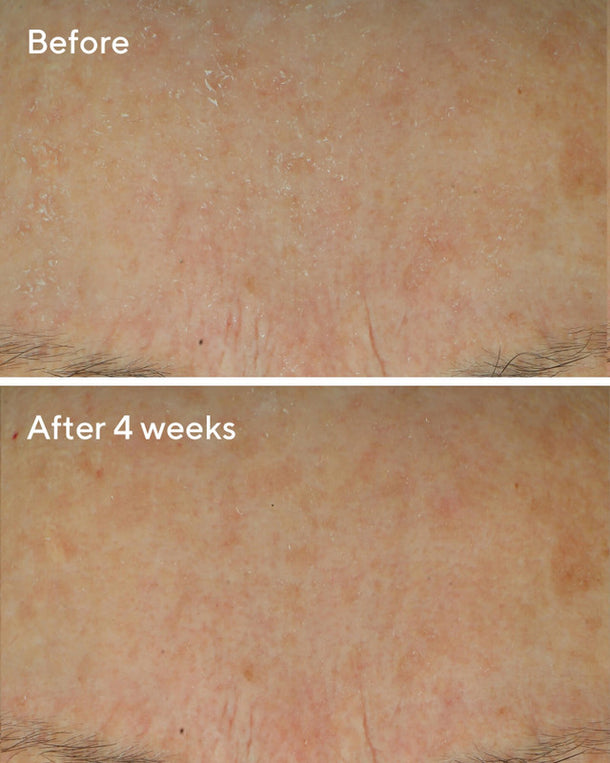 Murad - Crema de Defensa Diaria - Imagen 4