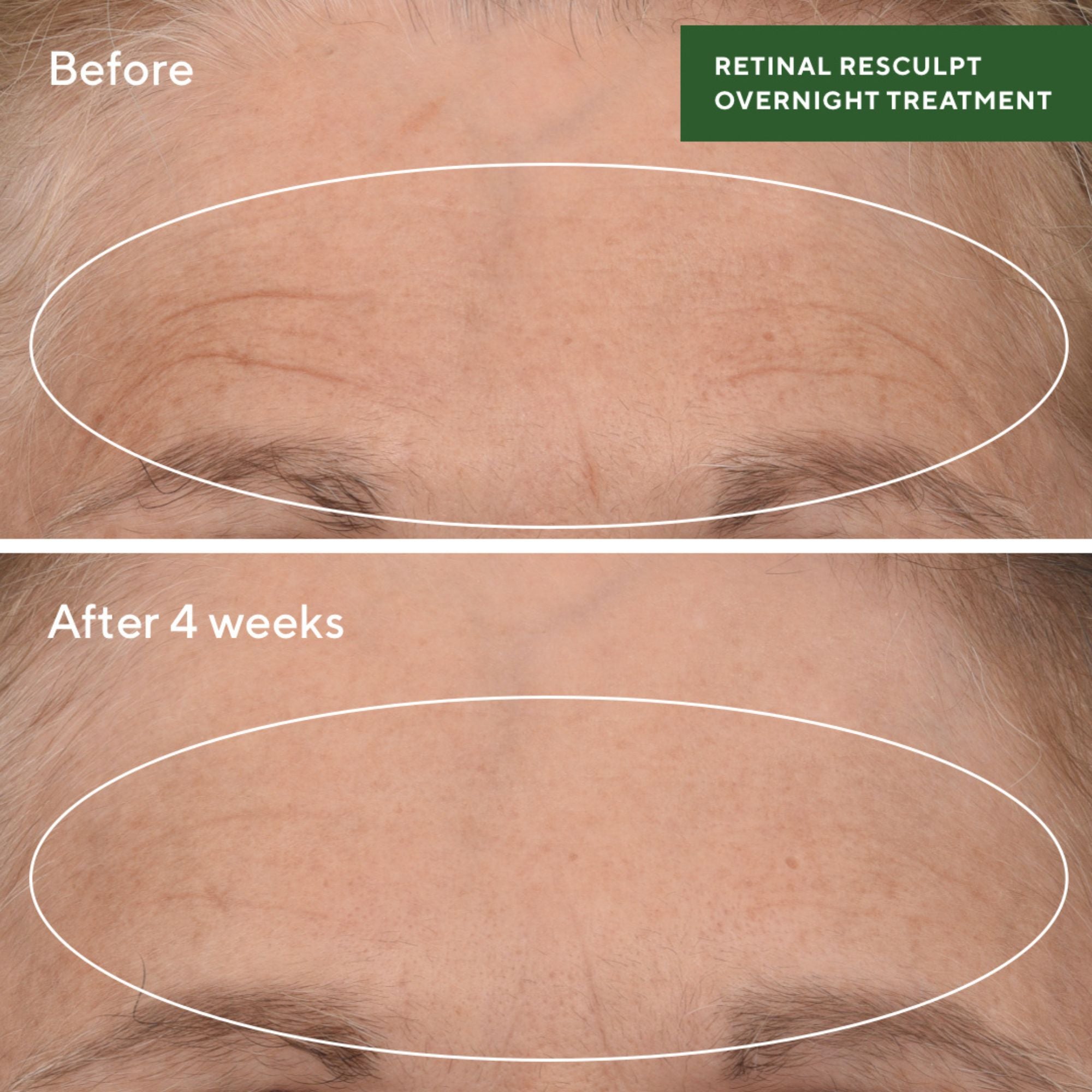 Retinal ReSculpt™ Overnight Treatment - Rejuvenece y mejora flacidez