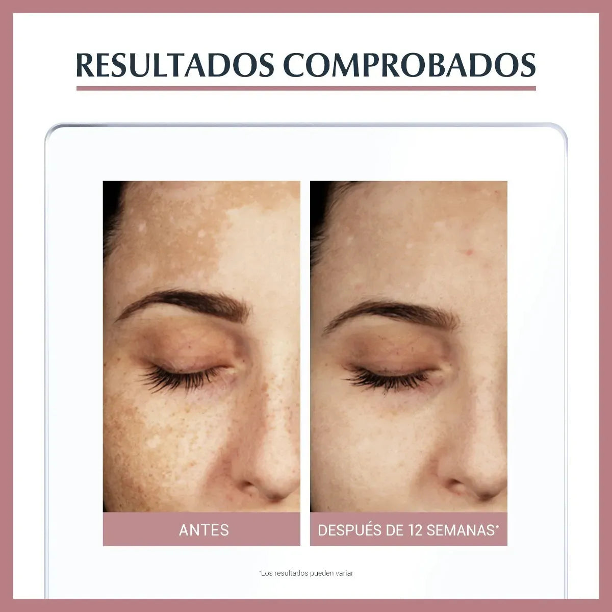 Anti-Pigment Dual Serum – Suero intensivo que reduce manchas y unifica el tono
