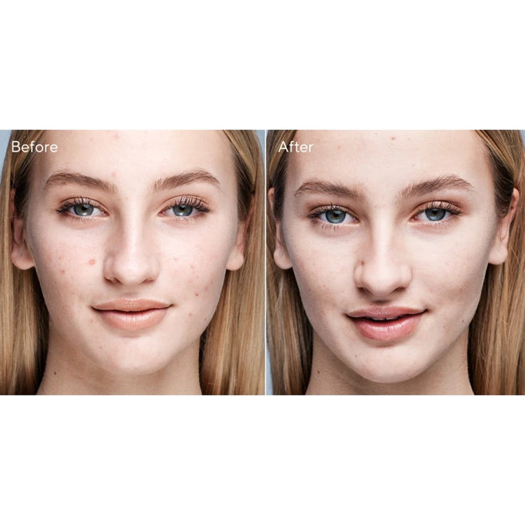 Murad - Tratamiento Clarificante para el Acné - Imagen 4